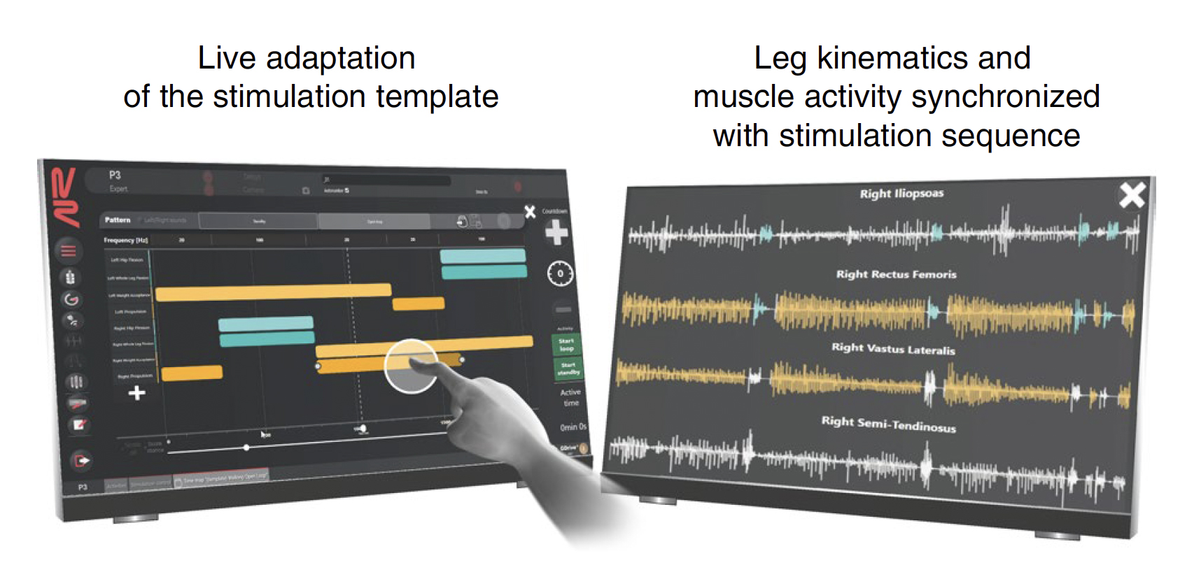 Patient's progress during Epidural Electrical Stimulation (EES) therapy, visualized with NeuroRestore powered by SciChart, showing walking stages and 