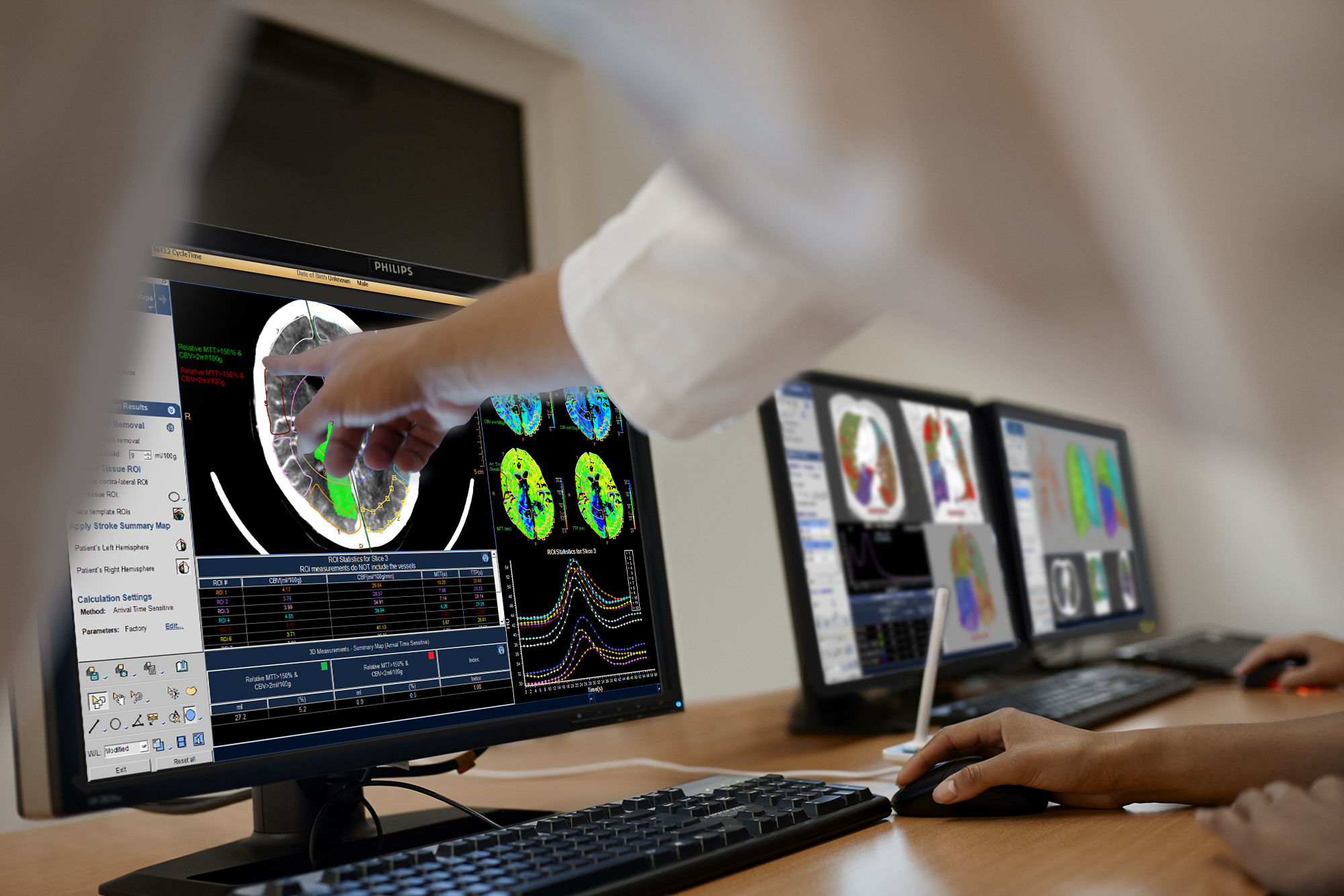 The IntelliSpace Portal that supports the diagnostic workflow
