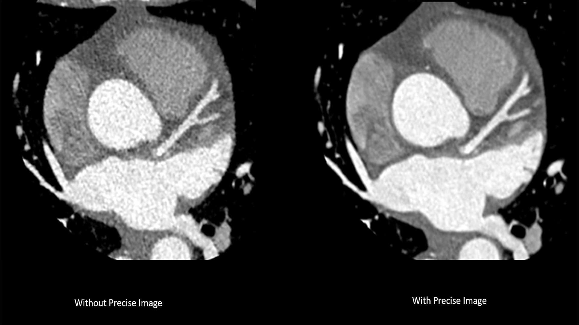 A clinical CT5300 cardiac scan image