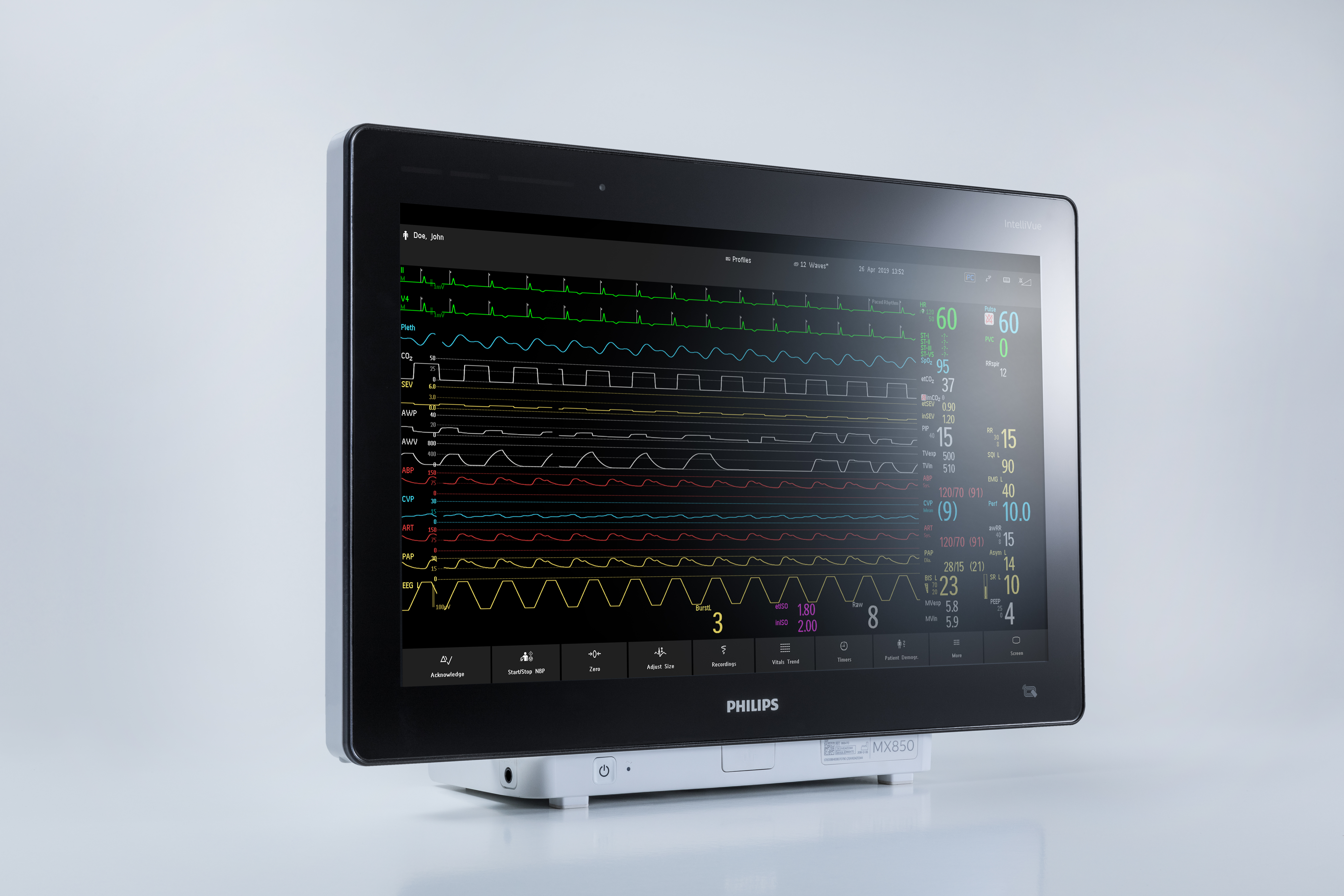 Philips IntelliVue Active Display, AD75 and AD85