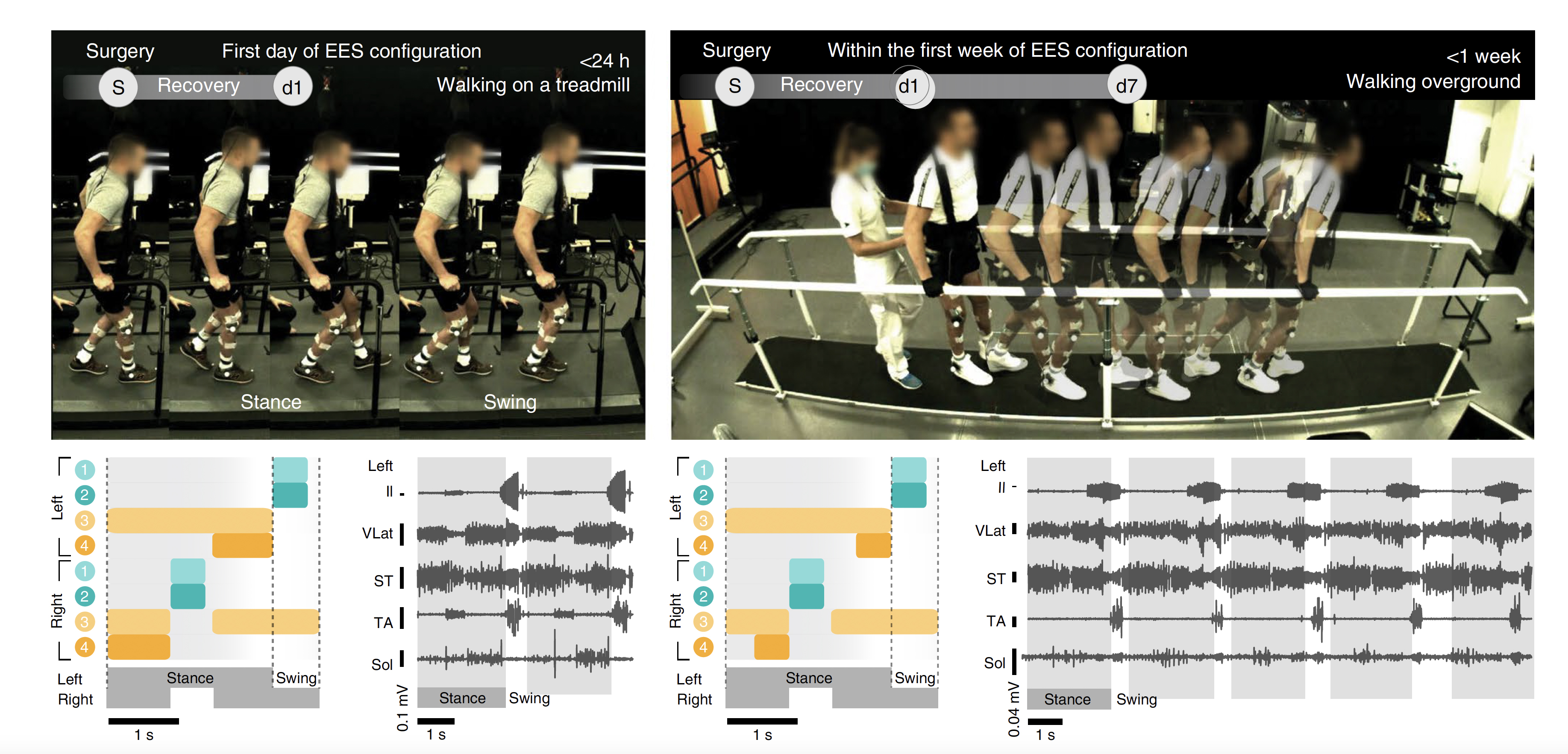 Patient's progress during Epidural Electrical Stimulation (EES) therapy, visualized with NeuroRestore powered by SciChart, showing walking stages and 