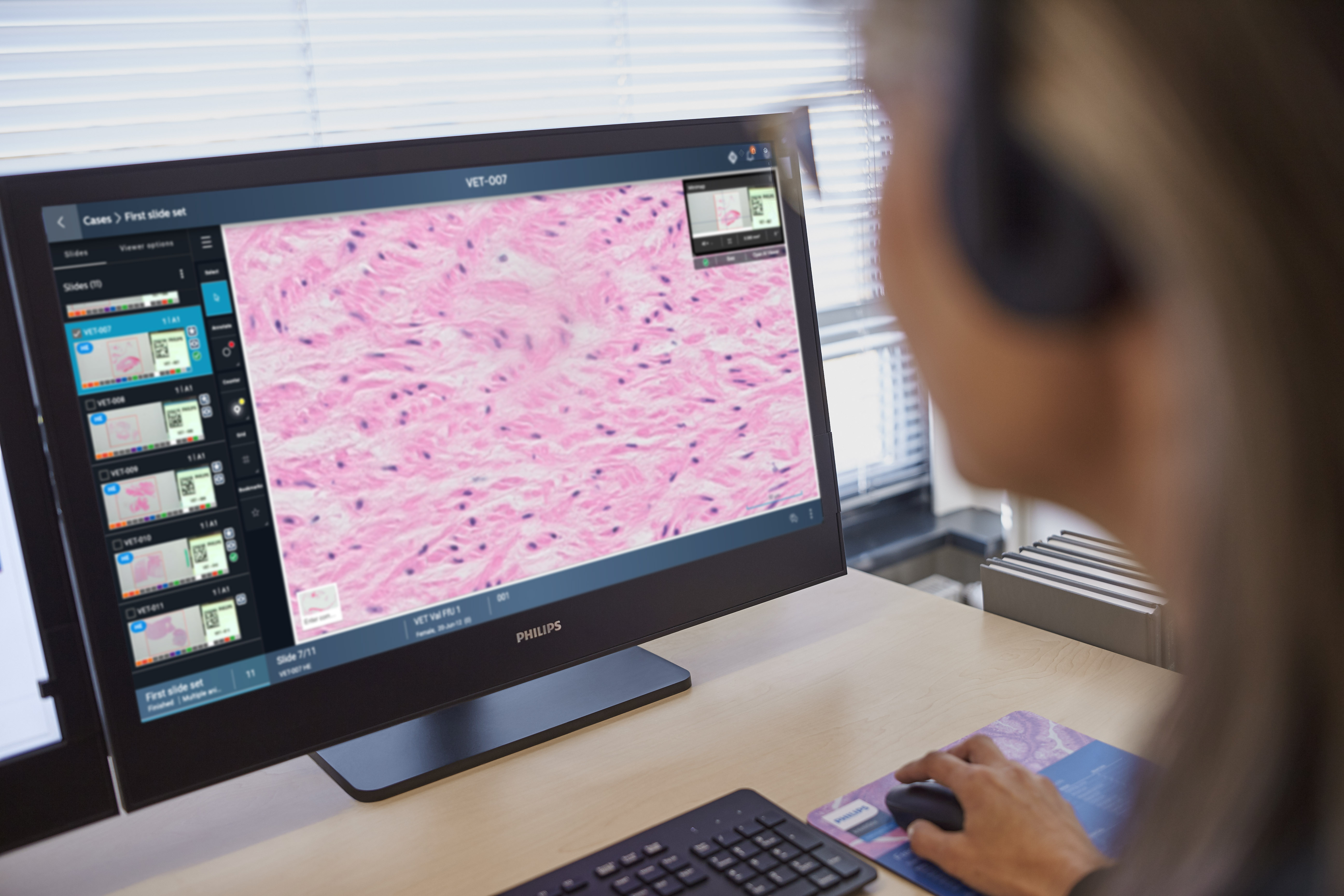 Clinician reviewing digital pathology slide