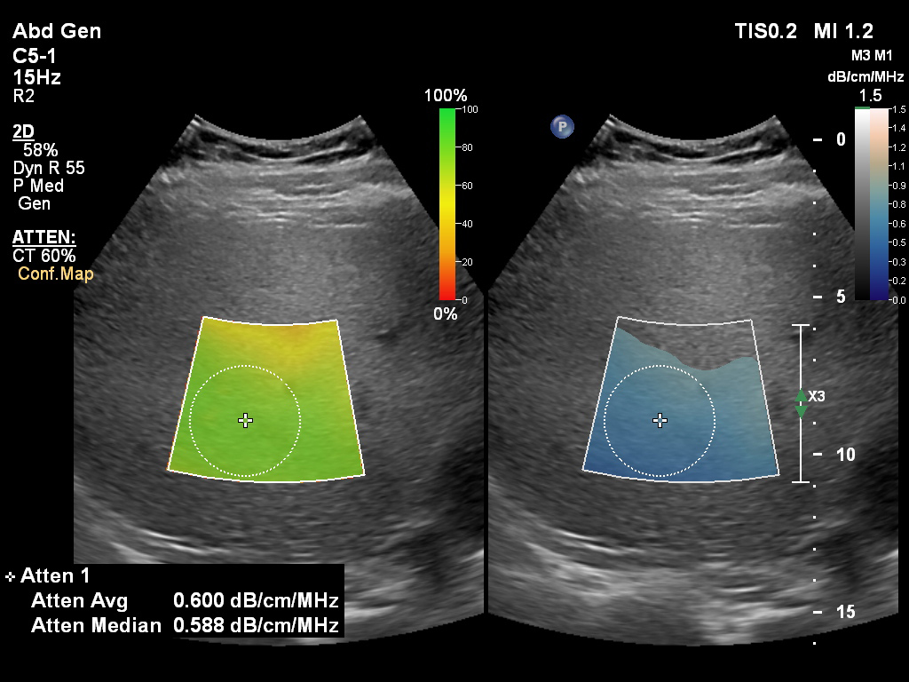 EPIC Ultrasound GI Liver image 1