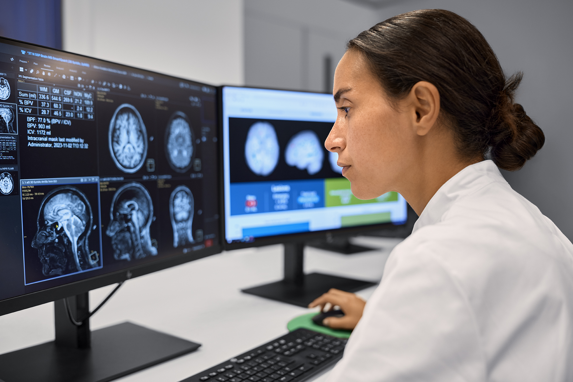 MR technologist reviews icometrix AI report on the Philips BlueSeal MRI console