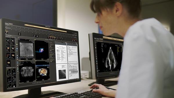 Cardiovascular Workspace image and information management solution in use