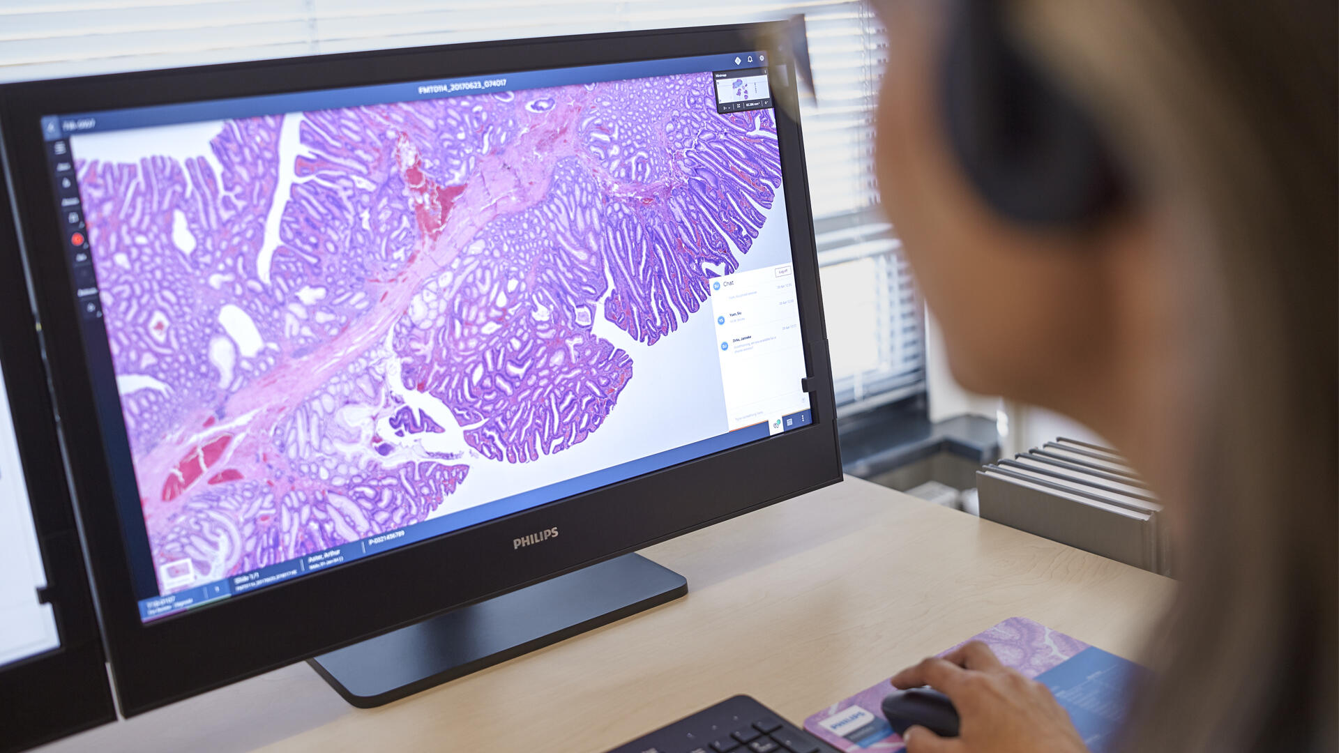 Digital Pathology