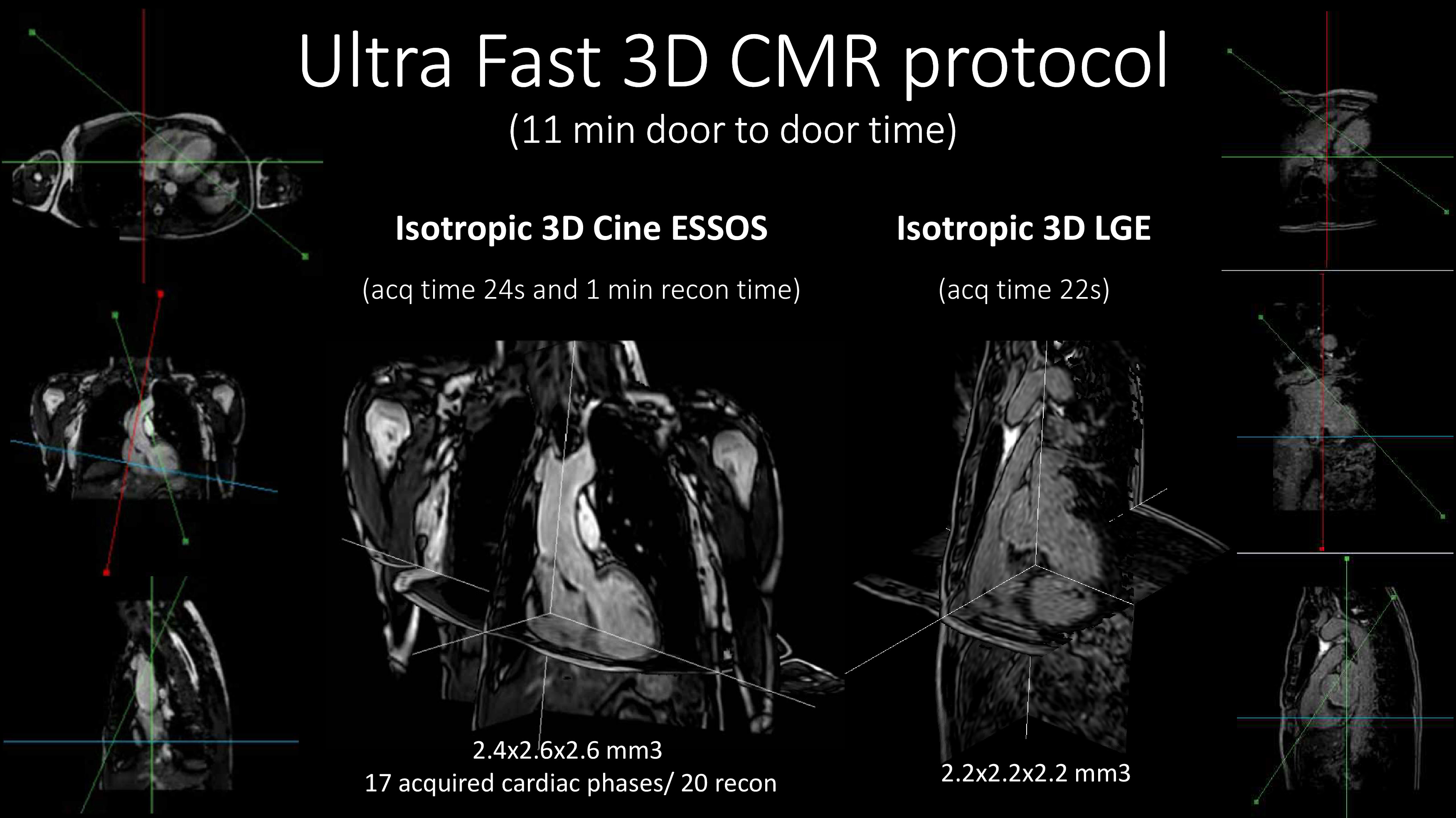 Ultra Fast 3C CMR protocol