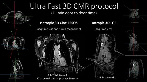 Ultra Fast 3C CMR protocol