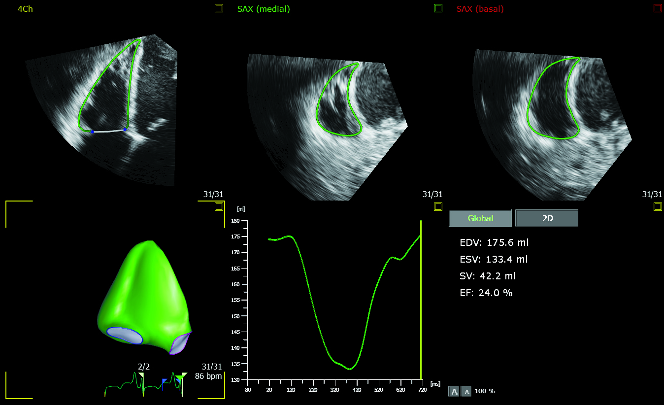 Image_showing_3D_Auto_RV_application