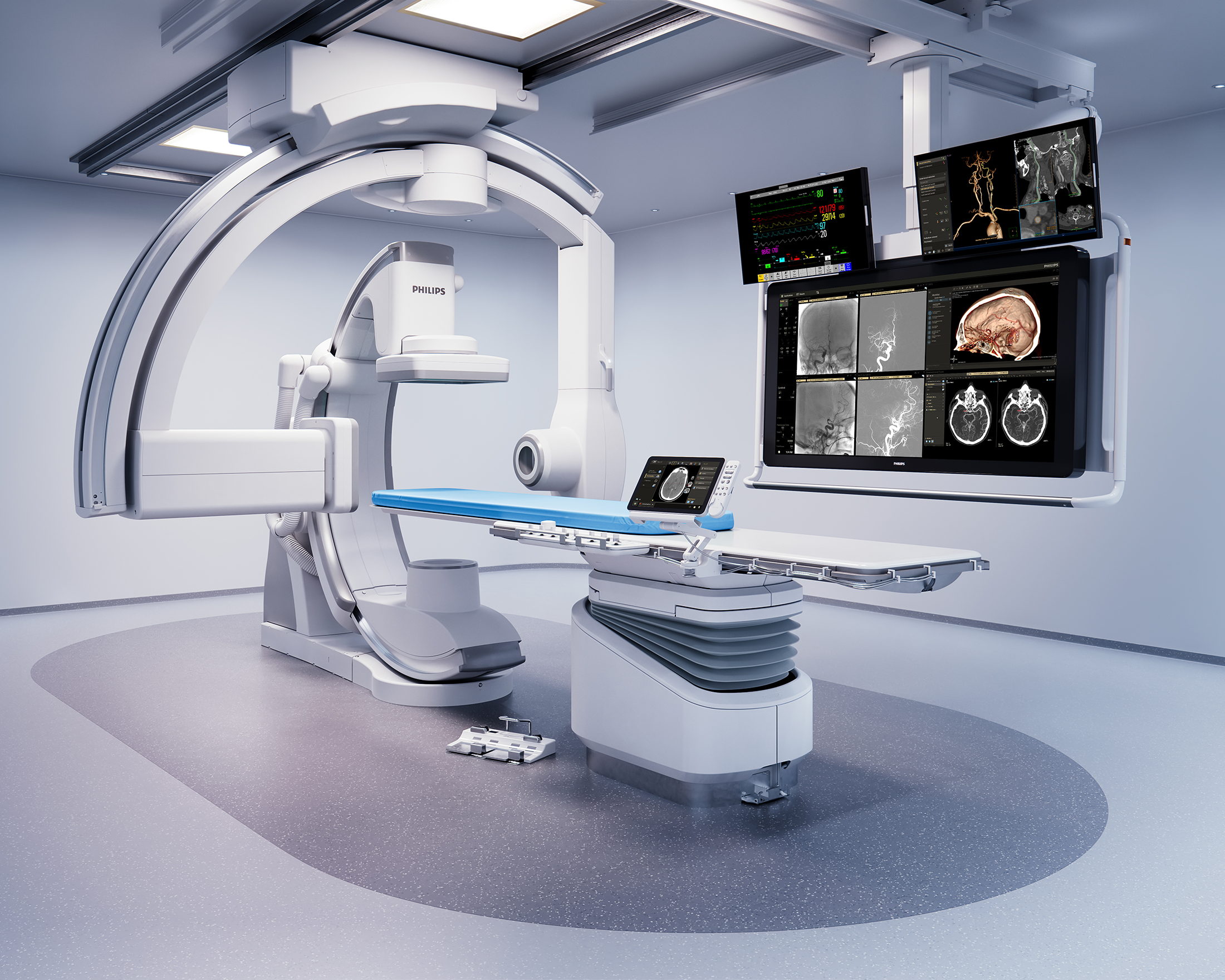 Philips launches new Azurion neuro biplane system at #ECR2024 to speed up and improve minimally invasive diagnosis and treatment of neurovascular patients