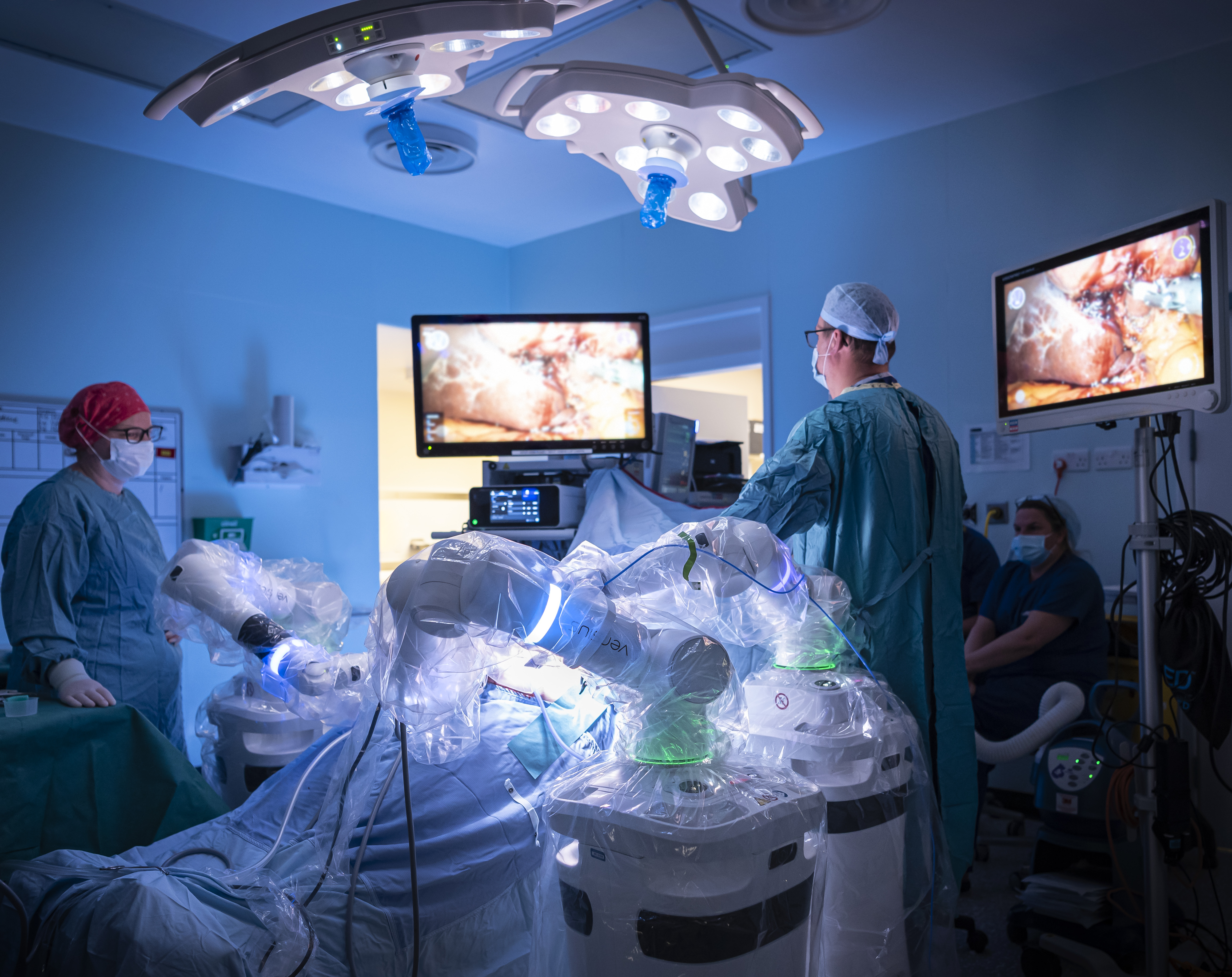 Image of the Versius Surgical System being used to perform a cholecystectomy at Gloucestershire Hospitals NHS Foundation Trust (Photo: CMR Surgical)