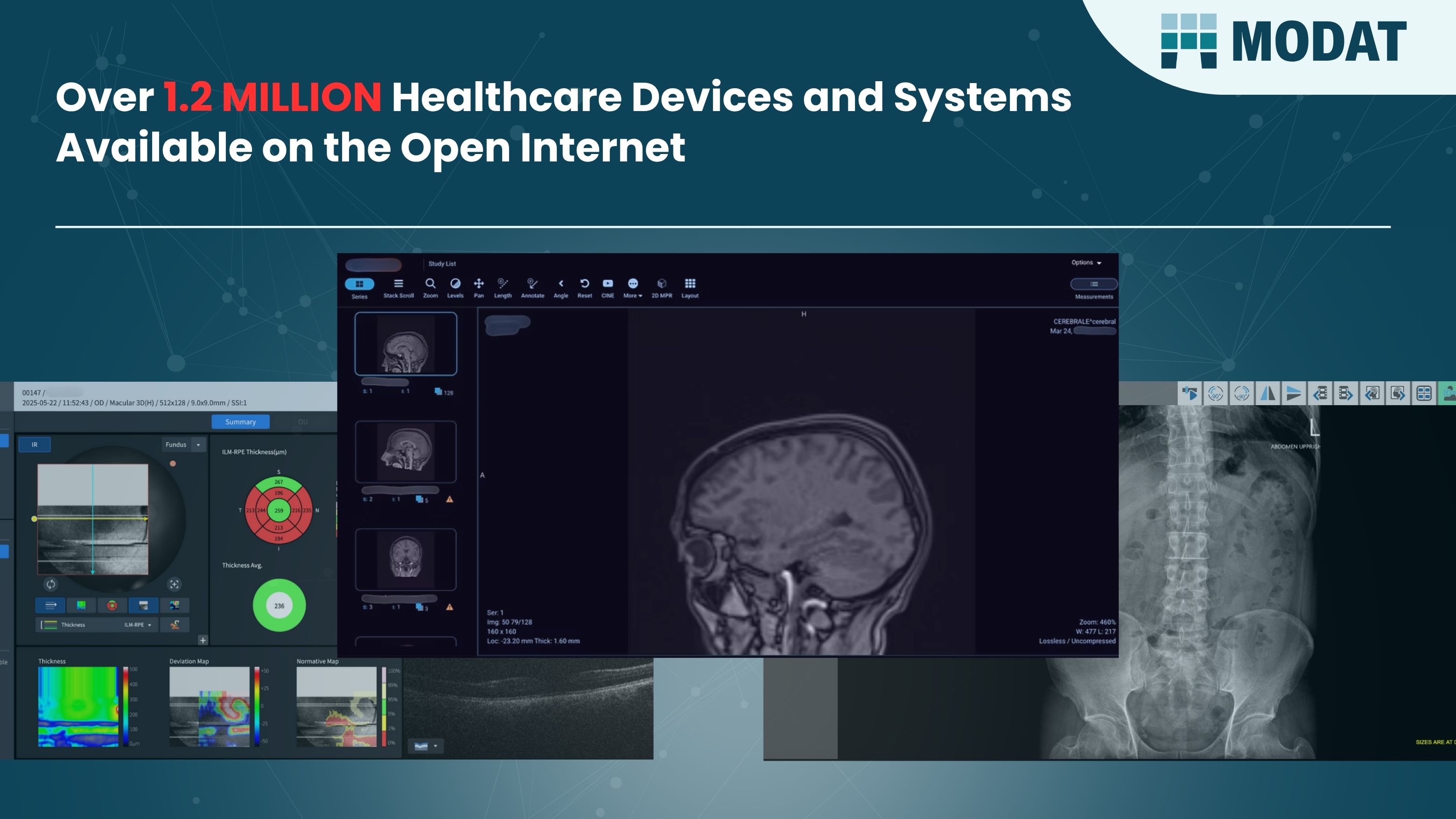 1.2 Million Healthcare Devices and Systems Found Exposed Online - Patient Records at Risk of Exposure, Latest Research from Modat