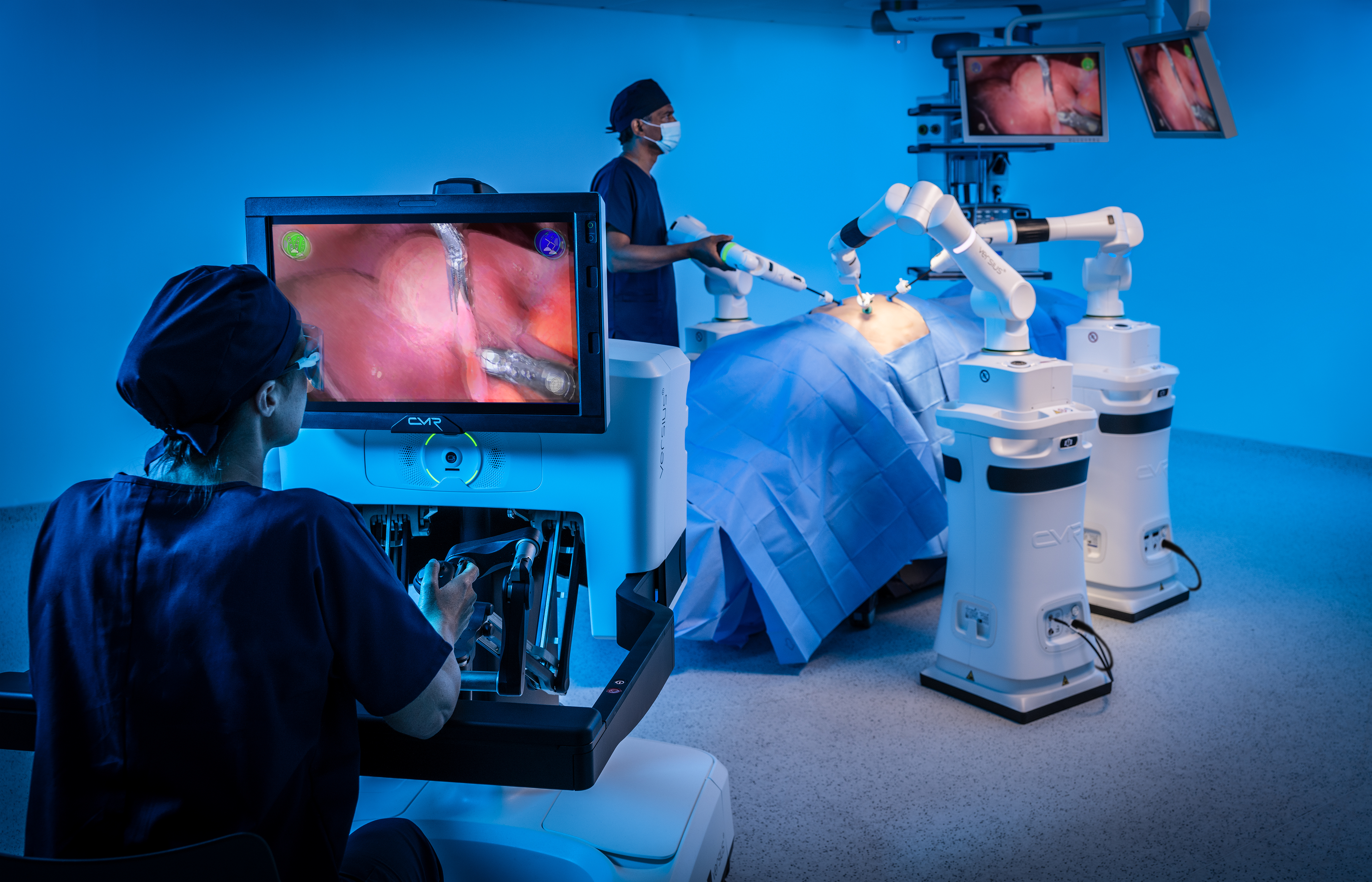 Image of the Versius Surgical System being used during a simulation of a cholecystectomy (Photo: CMR Surgical)