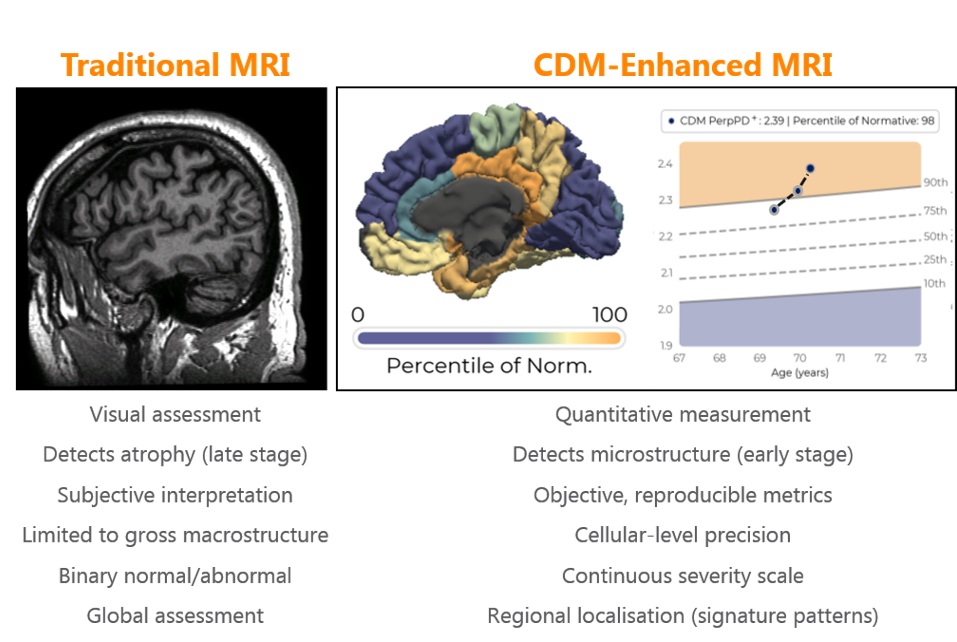 CDM Enriched MRI provides superior insights vs Traditional MRI scans.