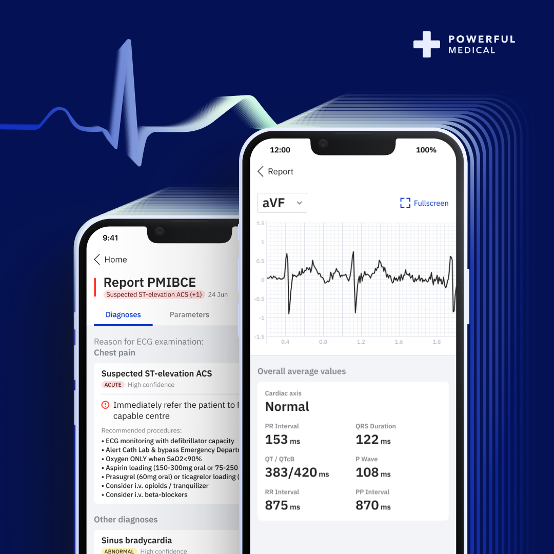 PMcardio_AI ECG interpretation and diagnostics_Powerful Medical