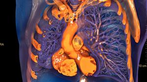 IntelliSpace Portal 12 Photorealistic Chest 3D Image